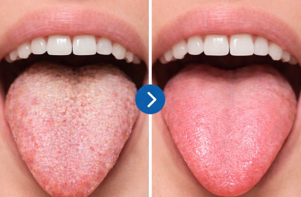 Grattoir pour Langue Inox - Élimine la Mauvaise Haleine | LaBoucheClaire